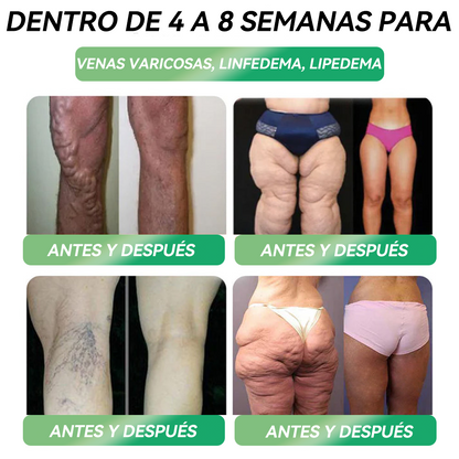 Tienda Oficial | 𝐻𝑯𝐕𝐁®🌿🌿𝐺𝐿𝑃-𝟏 𝑆𝑖𝑥 𝑖𝑛-𝑂𝑛𝑒 𝑆𝑜𝑙𝑢𝑐𝑖𝑜𝑛 𝑜𝑟𝑎𝑙 𝑙𝑖𝑞𝑢𝑖𝑑𝑎 (Solo una dosis al día, cambios visibles en 7 días) ✅ Para obesidad, salud cardiovascular, diabetes, apnea del sueño, problemas articulares y más.